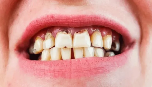 periodontal-surgeries-grafting-procedures-serivice-img
